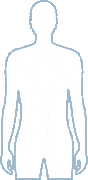 Medical diagram of a male body silhouette showing prostate cancer metastasis, with arrows pointing from the prostate to the liver, lungs, and bones